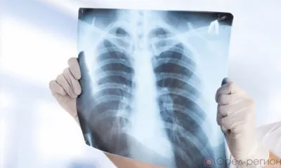 Орловцы смогут сделать бесплатную флюорографию на территории ТМК «ГРИНН»