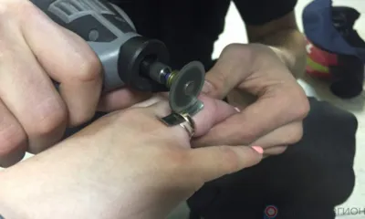 Орловчанке пришлось вызвать спасателей, чтобы снять кольцо с пальца