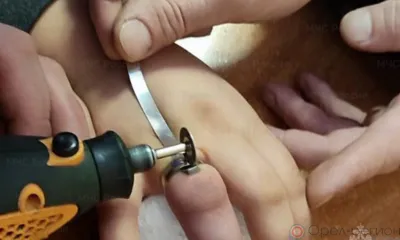 В Орле ребёнку потребовалась помощь спасателей, чтобы избавиться от кольца