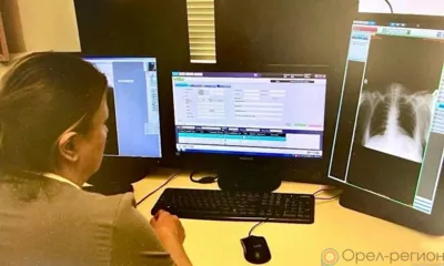 В Орле в больнице имени Семашко рентгенологические исследования стали цифровыми