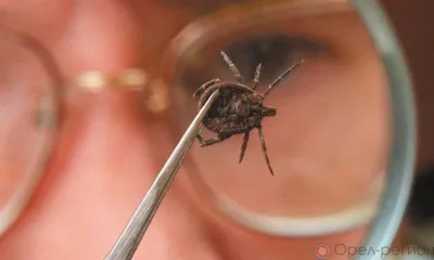 Более 300 жителей Орловской области пострадали от клещей