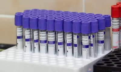 С начала 2023 года расширенный неонатальный скрининг прошли 1886 маленьких орловцев