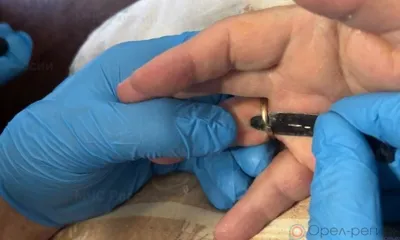 С пальца пожилой орловчанки сняли золотое кольцо