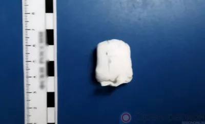 30-летний орловец подозревается в хранении наркотиков