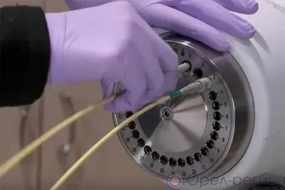 Орловский онкодиспансер в 2023 году может получить аппарат брахитерапии