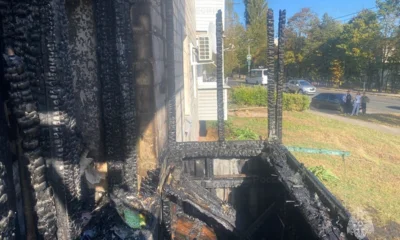 В Ливнах при пожаре пострадал мужчина