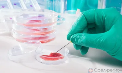 В пробе говяжьей печени, отобранной в пищеблоке орловской больницы, обнаружена ДНК свиньи