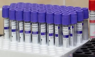 В Орловской области в 2022 году выявили более 3 тысяч случаев онкологии