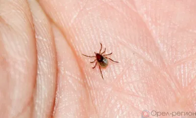У шести орловцев подтвердилась болезнь Лайма