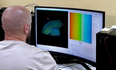 Учёные ОГУ им. И. С. Тургенева разрабатывают систему ранней диагностики диабета и болезни Альцгеймера