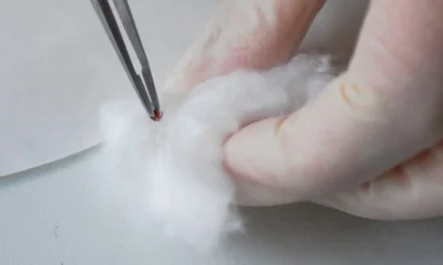 2581 орловец обратился за помощью после укусов клещей