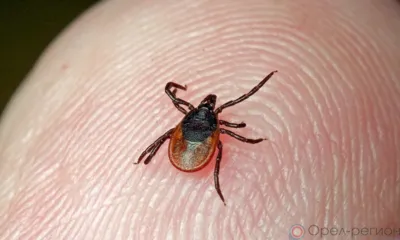 С начала года от укуса клещей пострадали более 1400 орловцев