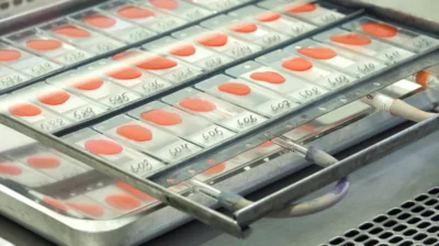 Фото 3. С 24 марта по 24 апреля в Орловской области объявлен месячник противотуберкулёзной пропаганды