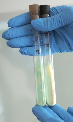 Фото 4. С 24 марта по 24 апреля в Орловской области объявлен месячник противотуберкулёзной пропаганды