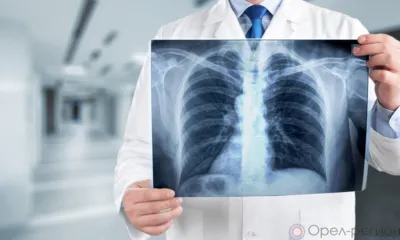 Орловцев приглашают на бесплатную флюорографию в передвижной мобильный центр