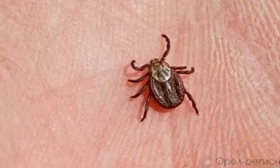 19 человек заразились иксодовым клещевым боррелиозом на Орловщине