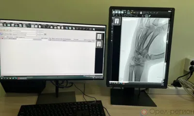 В Нарышкинской ЦРБ обновили оборудование на 17 млн рублей